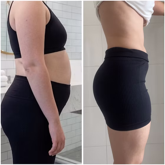 Customer-submitted progress photos and experience