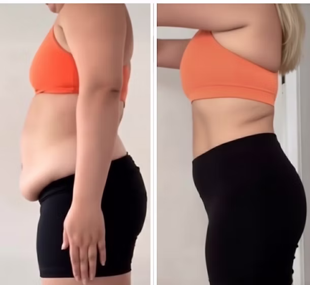 Customer-submitted progress photos and experience